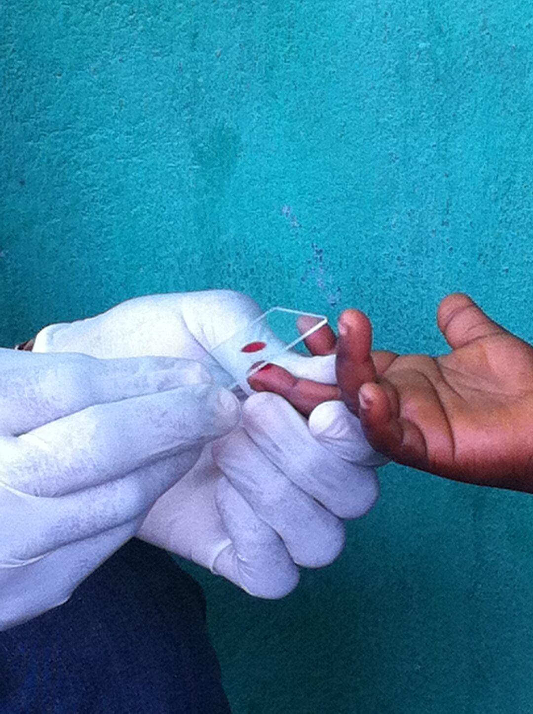 Diagnostics
